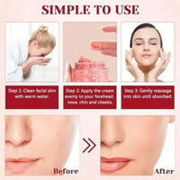 Anti-Aging Retinol Dragon Blood & Placenta Cream for Face Repair and Moisturizing